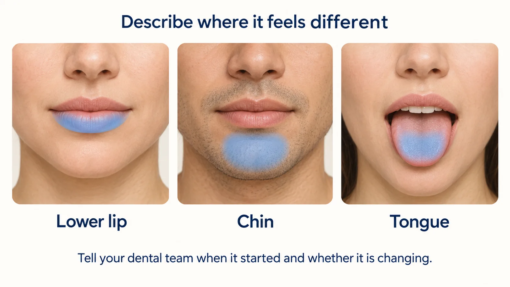 Educational illustration highlighting the lower lip, chin and tongue as areas to describe after wisdom teeth removal.